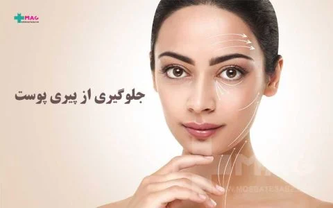 پوست 5 نکته برای پیشگیری از پیری زودرس پوست