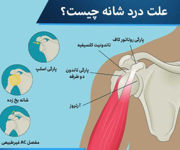 علت درد شانه چپ چیست؟