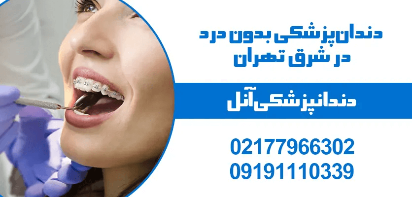 ویژگی‌ها و مشخصات یک کلینیک دندان پزشکی خوب و متخصص در شرق تهران