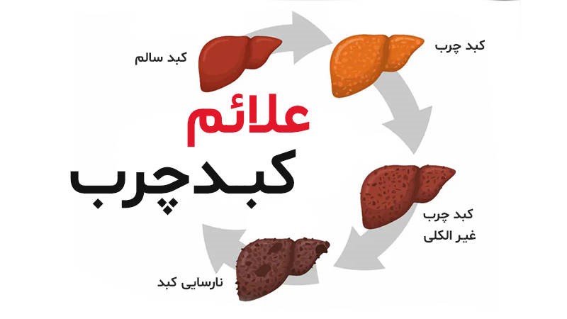 علائم بیماری کبدی